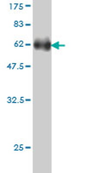 DEF6 monoclonal antibody (M01), clone 1F2