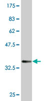 RRM2B monoclonal antibody (M01), clone 6C1