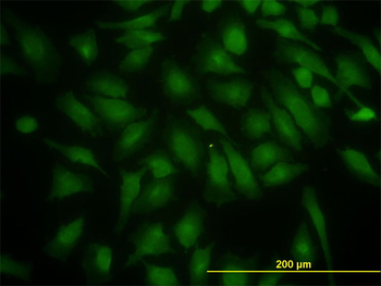 PIK3R4 monoclonal antibody (M02), clone 1B5