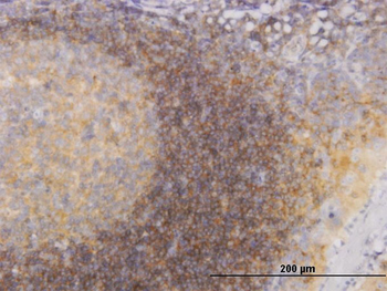 PIK3R4 monoclonal antibody (M02), clone 1B5
