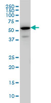 EHD3 monoclonal antibody (M01), clone 4B7