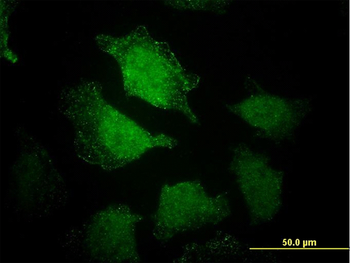EHD3 monoclonal antibody (M01), clone 4B7