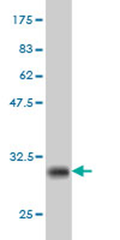 EHD3 monoclonal antibody (M01), clone 4B7