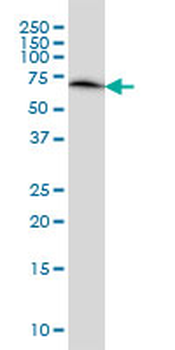 ERO1L monoclonal antibody (M01), clone 4G3
