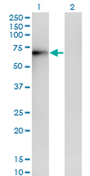 ERO1L monoclonal antibody (M01), clone 4G3