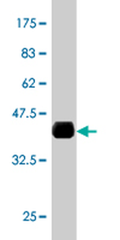 ERO1L monoclonal antibody (M01), clone 4G3