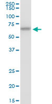 ERO1L polyclonal antibody (A01)