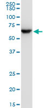 ERO1L polyclonal antibody (A01)