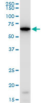 ERO1L polyclonal antibody (A01)