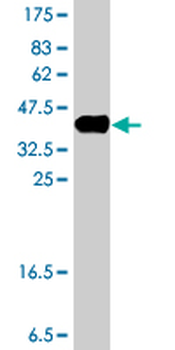 ERO1L polyclonal antibody (A01)