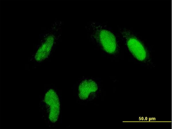 GLTSCR2 monoclonal antibody (M03), clone 5A8