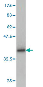 GLTSCR2 monoclonal antibody (M03), clone 5A8