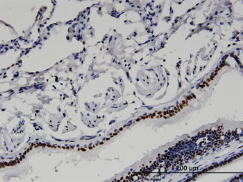 BAZ2B monoclonal antibody (M07), clone 2D10