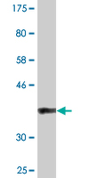 BAZ2B monoclonal antibody (M07), clone 2D10