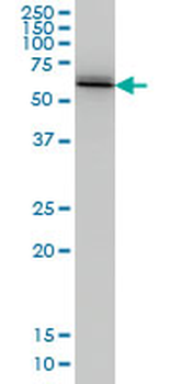 UBQLN2 monoclonal antibody (M03), clone 5F5