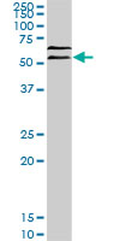 UBQLN2 monoclonal antibody (M03), clone 5F5