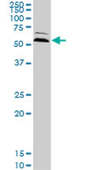 UBQLN2 monoclonal antibody (M03), clone 5F5