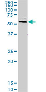 UBQLN2 monoclonal antibody (M03), clone 5F5