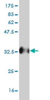 UBQLN2 monoclonal antibody (M03), clone 5F5