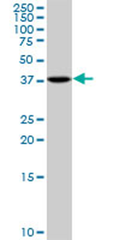 PSAT1 polyclonal antibody (A01)