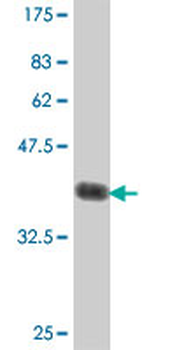PSAT1 polyclonal antibody (A01)