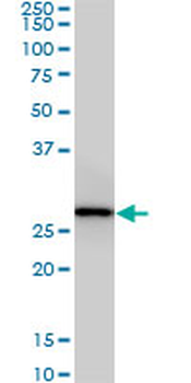 CNOT7 monoclonal antibody (M01A), clone 2F6