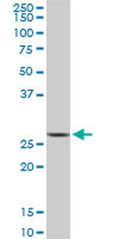 CNOT7 monoclonal antibody (M01A), clone 2F6