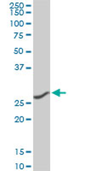 CNOT7 monoclonal antibody (M01A), clone 2F6