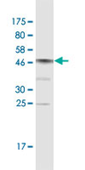 CNOT7 monoclonal antibody (M01A), clone 2F6