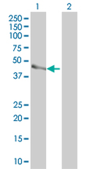 PARVB monoclonal antibody (M01), clone 4A11