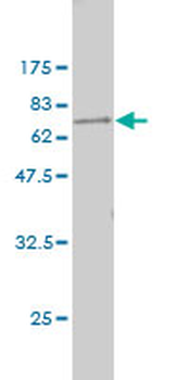 PARVB monoclonal antibody (M01), clone 4A11