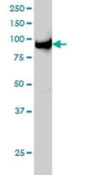 UHRF1 monoclonal antibody (M01), clone 3A11
