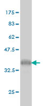 UHRF1 monoclonal antibody (M01), clone 3A11