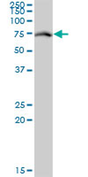 RACGAP1 monoclonal antibody (M01), clone 1G6