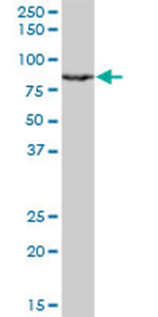 RACGAP1 monoclonal antibody (M01), clone 1G6