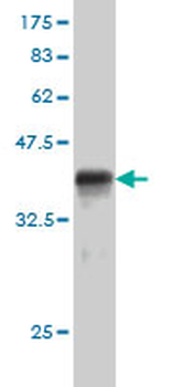 RACGAP1 monoclonal antibody (M01), clone 1G6
