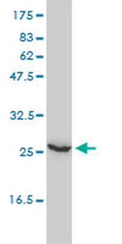 UBE2T monoclonal antibody (M01), clone 1E12-4A3