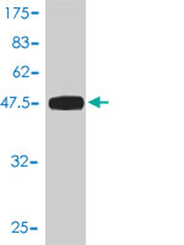 UBE2T monoclonal antibody (M01), clone 1E12-4A3