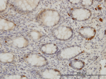 TRIB2 monoclonal antibody (M04), clone 1B1