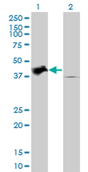 TRIB2 monoclonal antibody (M04), clone 1B1
