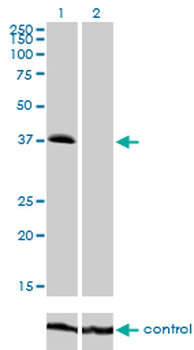 TRIB2 monoclonal antibody (M04), clone 1B1