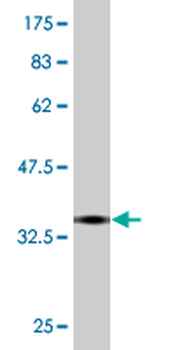 TRIB2 monoclonal antibody (M04), clone 1B1