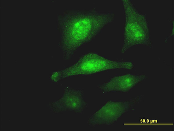 PCSK1N monoclonal antibody (M02), clone 1E9