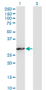 PCSK1N monoclonal antibody (M02), clone 1E9