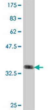 PRPF19 polyclonal antibody (A01)
