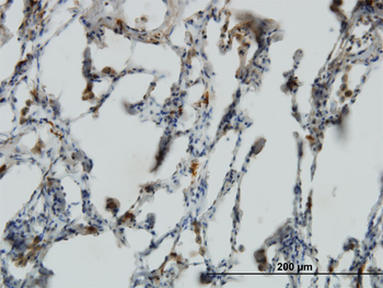 PRELID1 monoclonal antibody (M01), clone 7B4