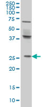 PRELID1 monoclonal antibody (M01), clone 7B4