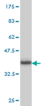 PRELID1 monoclonal antibody (M01), clone 7B4