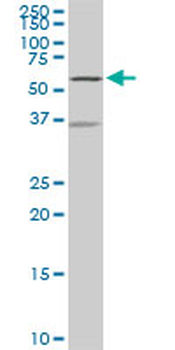 NDOR1 monoclonal antibody (M01), clone 3A11