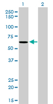 NDOR1 monoclonal antibody (M01), clone 3A11
